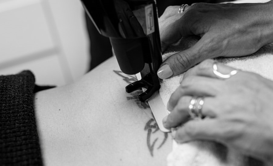 ¿Es más fácil quitar un tatuaje nuevo o viejo?